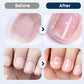 Nagelvårdsspray för Reparation & Styrka