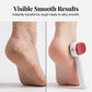 🔥Ultimo giorno 60% di sconto✨Raschietto per piedi a doppia faccia – Rimuove facilmente calli e pelle morta 🦶